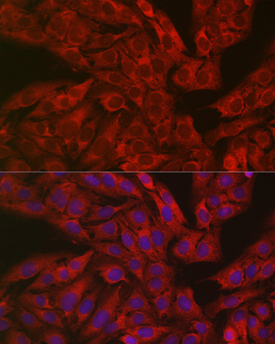 GSDME (Full length+N terminal)Rabbit polyclonal antibody