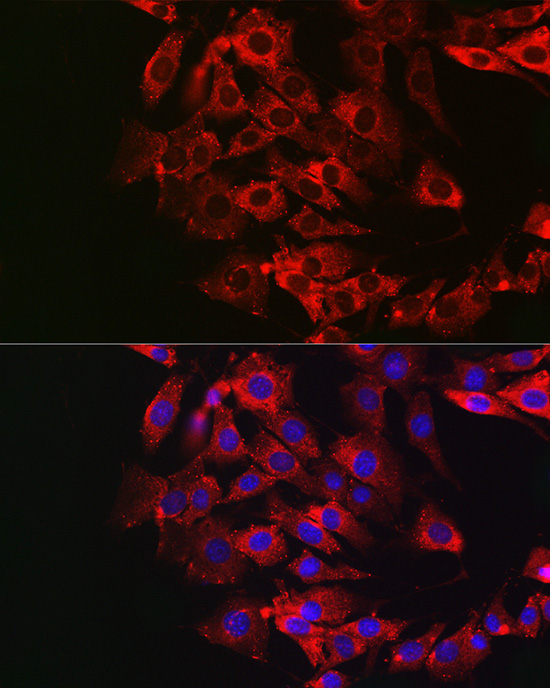 GSDME (Full length+N terminal)Rabbit polyclonal antibody