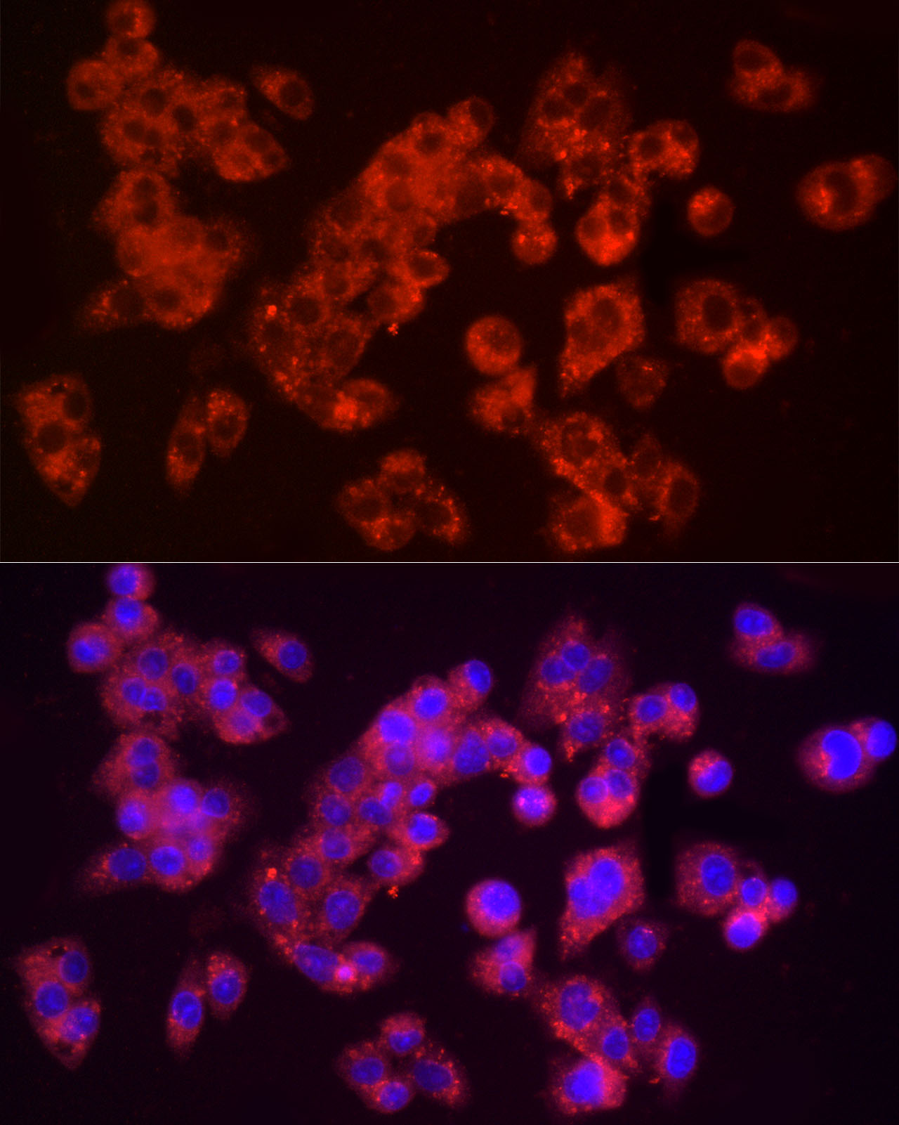 Furin Rabbit polyclonal antibody