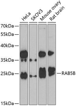 RAB5B Rabbit polyclonal antibody