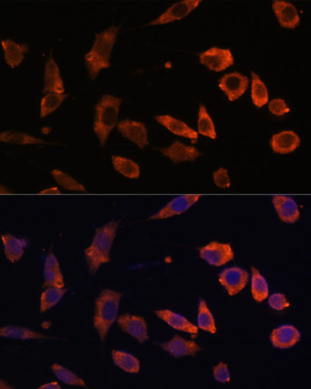 RAB5B Rabbit polyclonal antibody