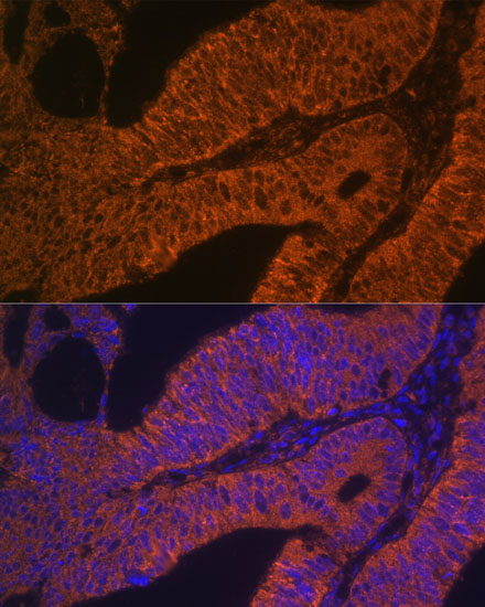 RAB5B Rabbit polyclonal antibody