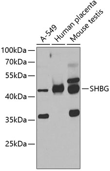 SHBG Rabbit polyclonal antibody