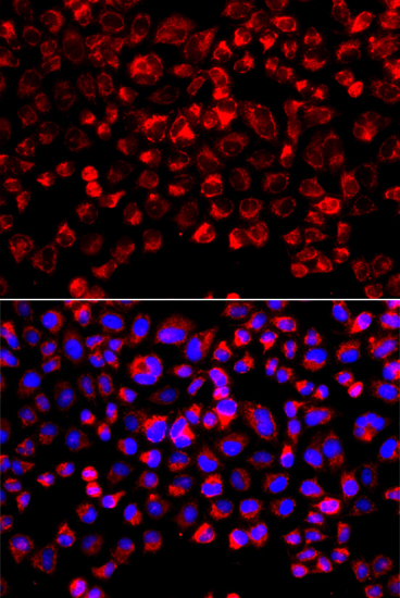 SULT1E1 Rabbit polyclonal antibody