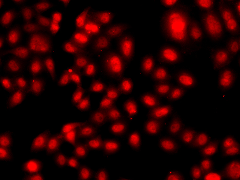 TEAD3 Rabbit polyclonal antibody