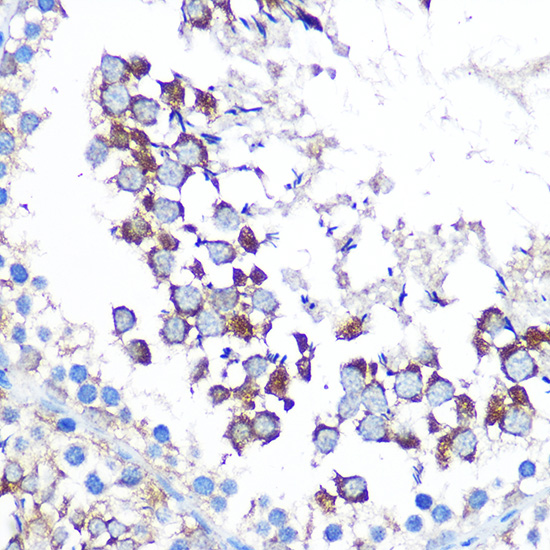 WISP2 Rabbit polyclonal antibody