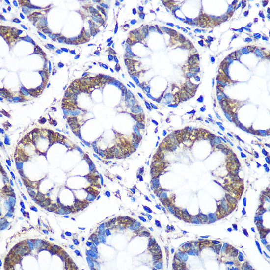 WISP2 Rabbit polyclonal antibody