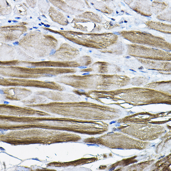 LDB3 Rabbit polyclonal antibody