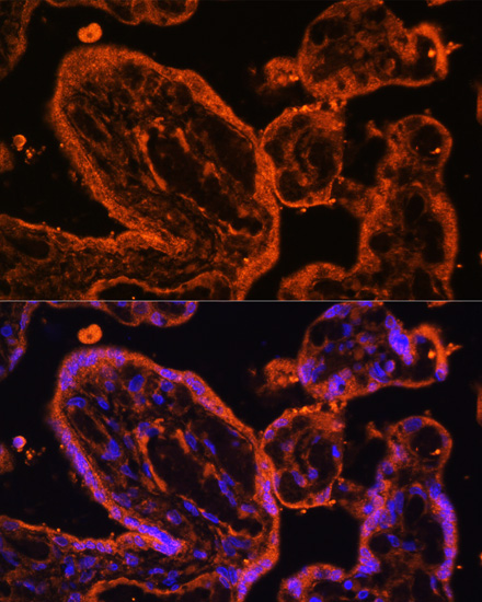 LDB3 Rabbit polyclonal antibody