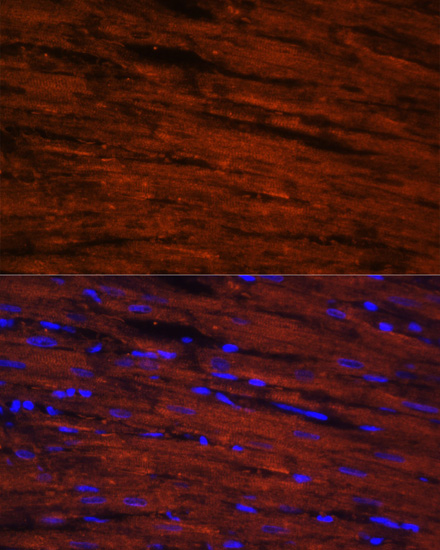 LDB3 Rabbit polyclonal antibody