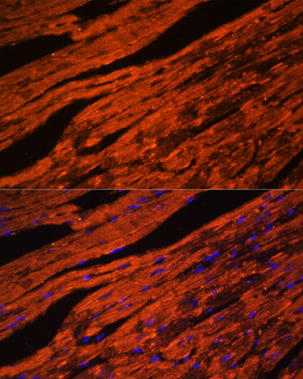 LDB3 Rabbit polyclonal antibody
