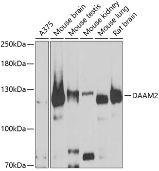 DAAM2 Rabbit polyclonal antibody