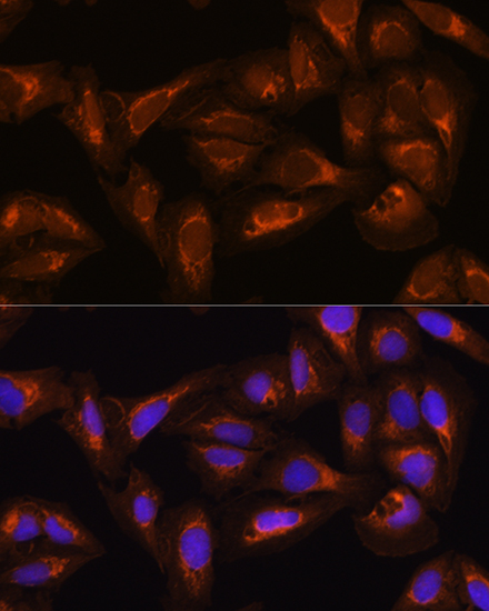 DAAM2 Rabbit polyclonal antibody