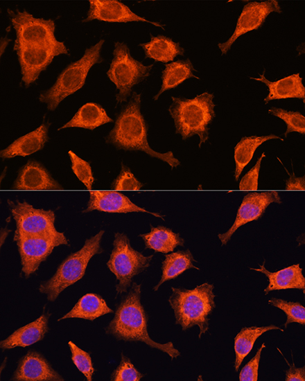 DAAM2 Rabbit polyclonal antibody
