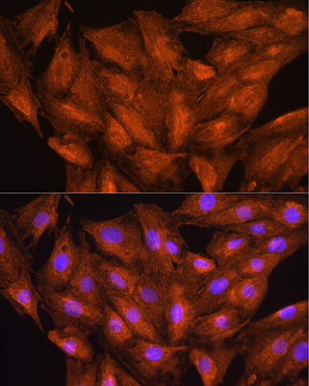 DAAM2 Rabbit polyclonal antibody