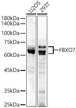 FBXO7 Rabbit polyclonal antibody