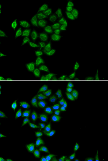 COQ3 Rabbit polyclonal antibody