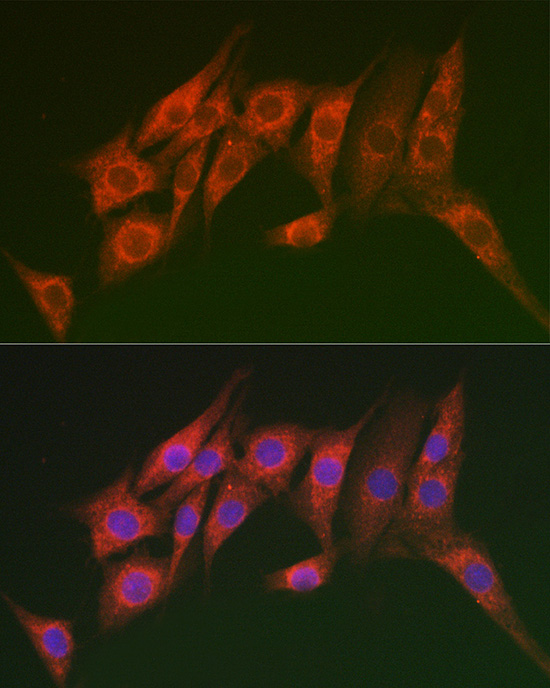 MTMR14 Rabbit polyclonal antibody