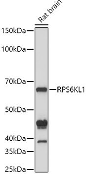 RPS6KL1 Rabbit polyclonal antibody