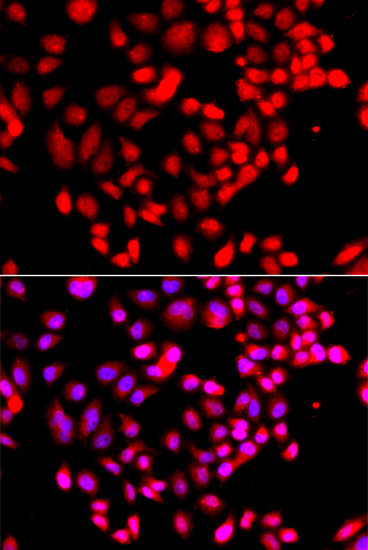RPS6KL1 Rabbit polyclonal antibody