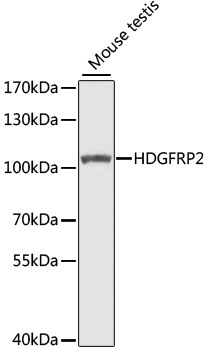 HDGFRP2 Rabbit polyclonal antibody