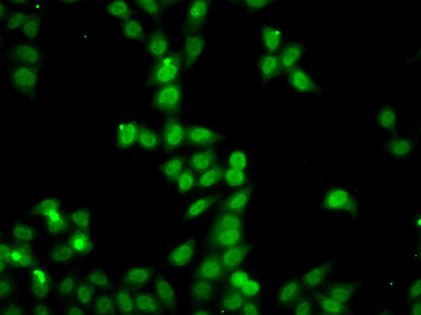 HDGFRP2 Rabbit polyclonal antibody