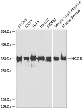 HCCS Rabbit polyclonal antibody