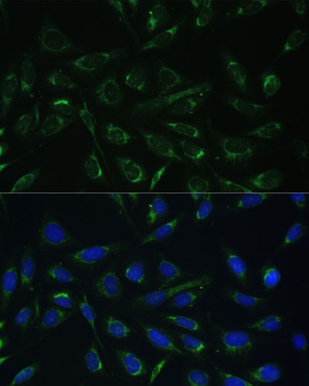 HCCS Rabbit polyclonal antibody