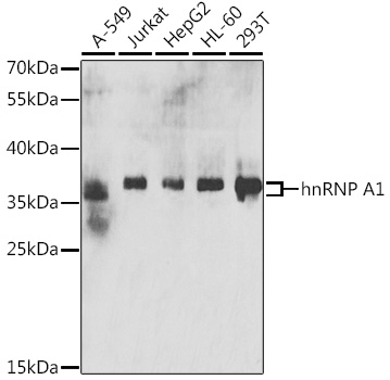 hnRNP A1 Rabbit polyclonal antibody