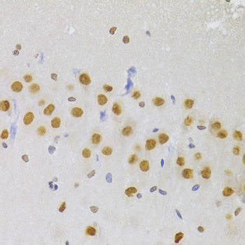 hnRNP A1 Rabbit polyclonal antibody