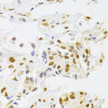 hnRNP A1 Rabbit polyclonal antibody