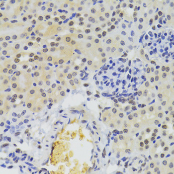 hnRNP A1 Rabbit polyclonal antibody