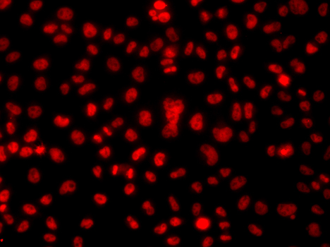 hnRNP A1 Rabbit polyclonal antibody