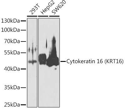 Cytokeratin 16 (KRT16) Rabbit polyclonal antibody