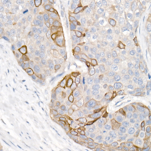 Cytokeratin 16 (KRT16) Rabbit polyclonal antibody