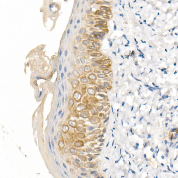 Cytokeratin 16 (KRT16) Rabbit polyclonal antibody