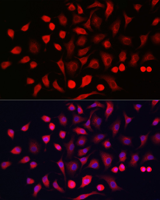 Cytokeratin 16 (KRT16) Rabbit polyclonal antibody