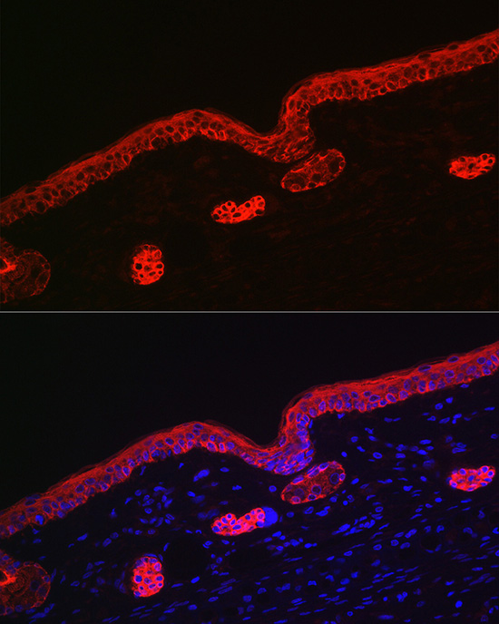 Cytokeratin 16 (KRT16) Rabbit polyclonal antibody