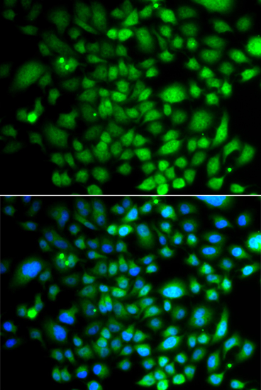 PTK6 Rabbit polyclonal antibody
