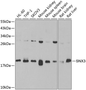 SNX3 Rabbit polyclonal antibody