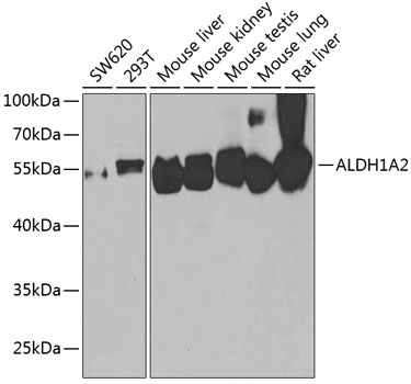 ALDH1A2 Rabbit polyclonal antibody