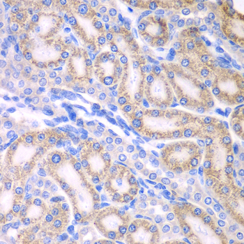 ALDH1A2 Rabbit polyclonal antibody