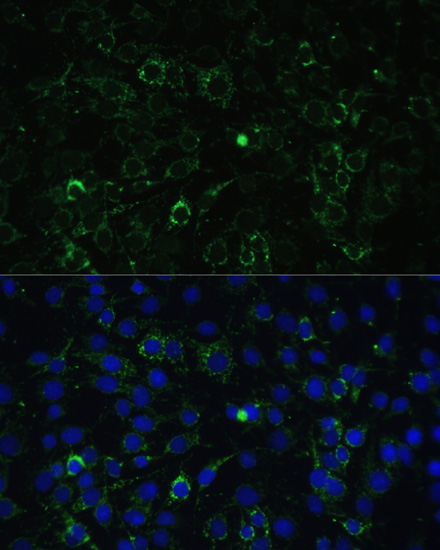 ALDH1A2 Rabbit polyclonal antibody