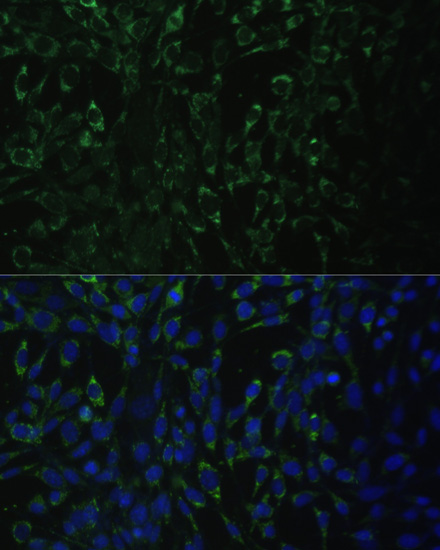 ALDH1A2 Rabbit polyclonal antibody