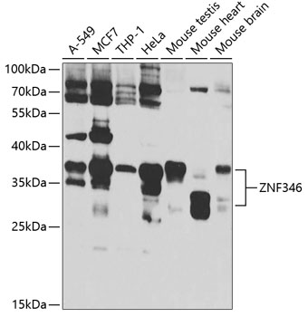 ZNF346 Rabbit polyclonal antibody