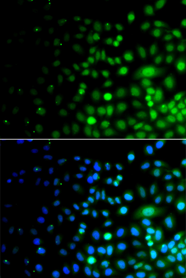 UBA6 Rabbit polyclonal antibody