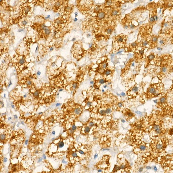 COX1 Rabbit polyclonal antibody