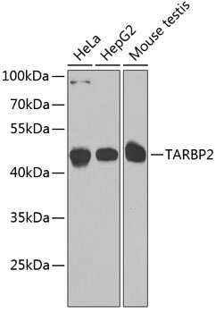 TARBP2 Rabbit polyclonal antibody