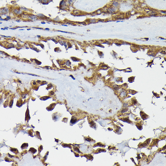 TARBP2 Rabbit polyclonal antibody