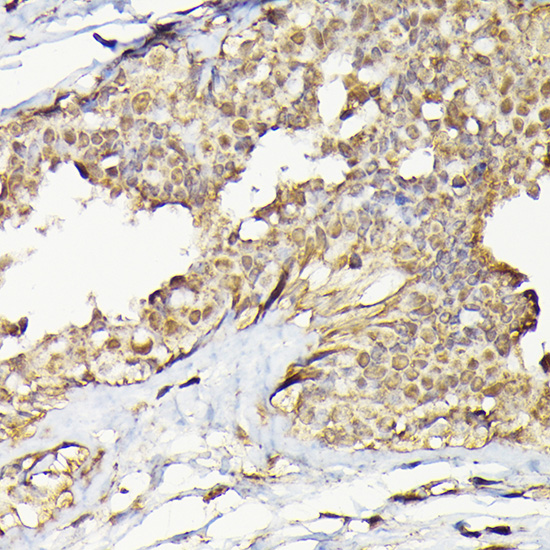 TARBP2 Rabbit polyclonal antibody